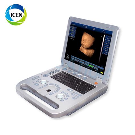 IN A8 3D Full Digital Laptop Color Doppler USG Ultrasound Scanner