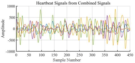 Sensors Free Full Text Non Contact Heart Rate Monitoring Method