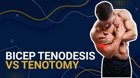 5 Critical Bicep Tenodesis VS Tenotomy Surgery Differences