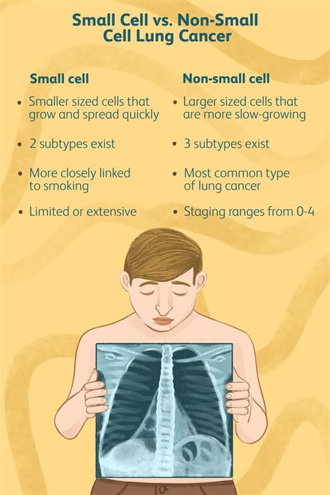 Small Cell Vs Non Small Cell Lung Cancer