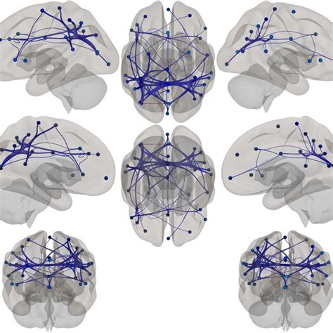 Mosaic Showing Brain Location Of Atlas Based Functional Connectivity