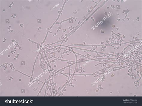 Budding Yeast Cell Structure Fine Microscope Stock Photo