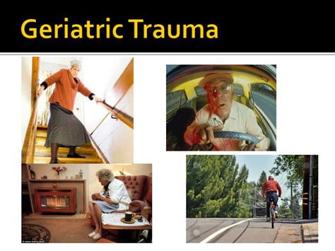 Ppt The Elderly Trauma Patient Trauma Care Beyond The Ed Powerpoint