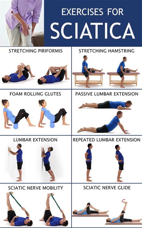 Sciatica Exercises And Treatment Options Artofit