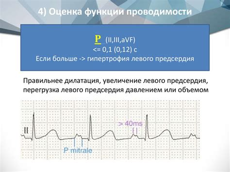 Анализ ЭКГ - презентация онлайн