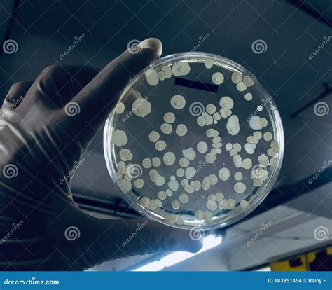 Microbiology Bacillus Sp Bacteria on Culture Media Plate Stock Photo - Image of media, medium ...