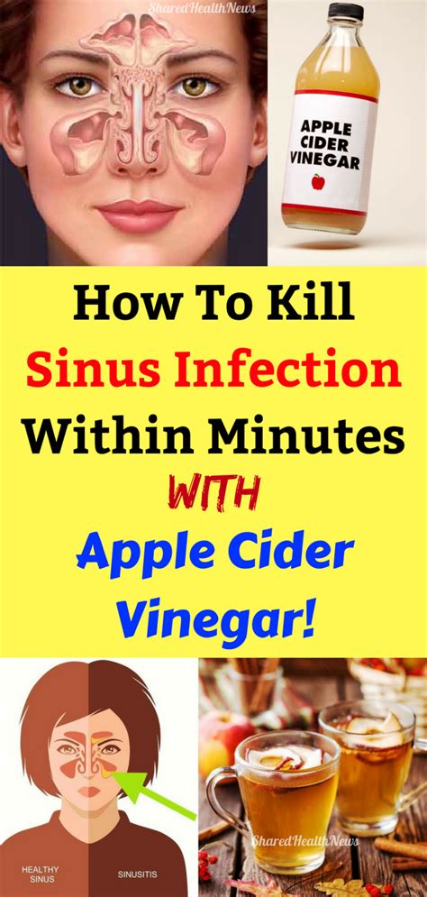 Shared Health News How To Kill Sinus Infection Within Minutes With Apple Cider Vinegar