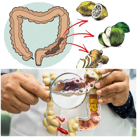 9 Remedios Caseros Para La Limpieza Natural Del Colon Corte De Pelo