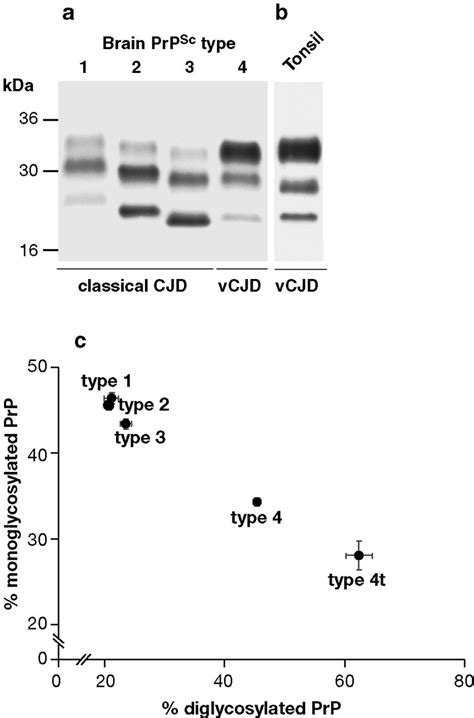 Human Prp Sc Types A Western Blot Developed With Monoclonal Antibody