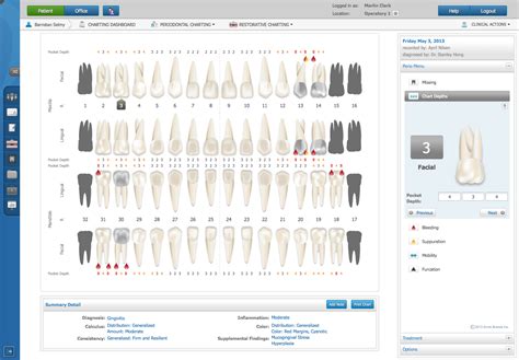 Dental Charting Practice Examples: A Visual Reference of Charts | Chart ...