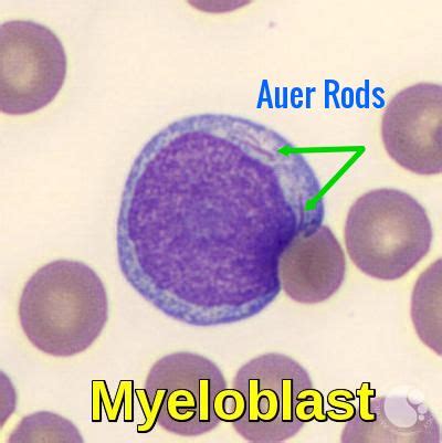 Blood Morphology Ask Hematologist Understand Hematology Medical