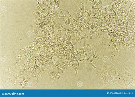 Pseudohyphae On Microscope