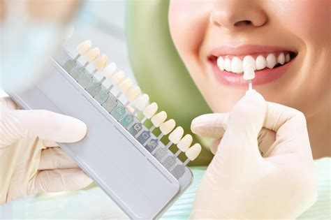 What Are Dental Veneers Everything You Need To Know The Braces Practice