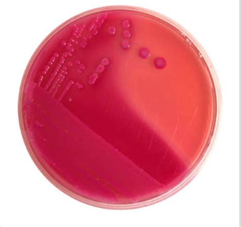 Clinical Microbiology Unit 1 Flashcards Quizlet