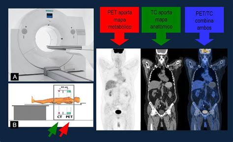 PET TC Oncología Esperanzadora