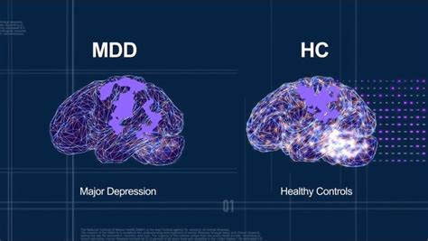 Ketamine Effects On The Brain