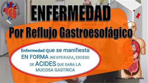 Enfermedad De Reflujo Gastroesofágico Erge Youtube