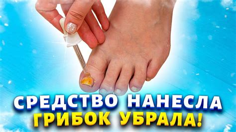 Масло бергамота от грибка ногтей отзывы: состав, свойства, рецепты