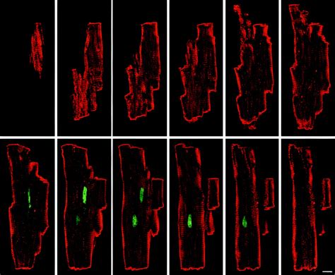 Bcl 2 Overexpression Promotes Myocyte Proliferation Pnas