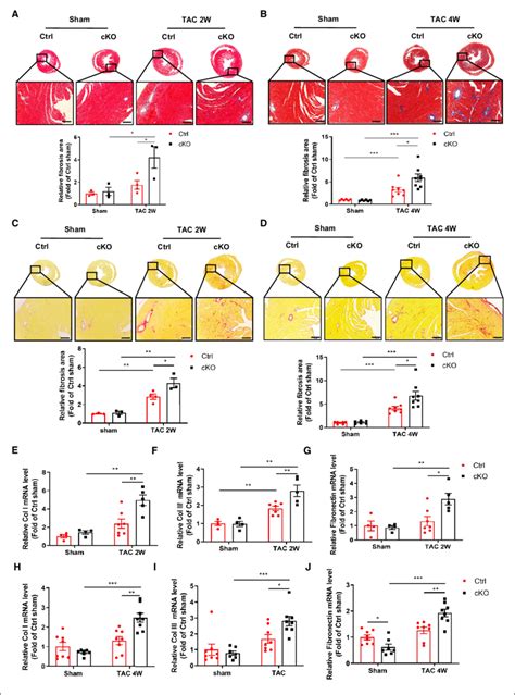 Deficiency Of Bmal In Cardiomyocytes Accelerates Tac Induced Cardiac