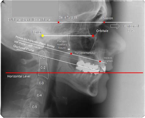 Page Not Found Occlusion Connections™