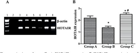 Figure From Effects Of Lncrna Hotair On Proliferation And Apoptosis