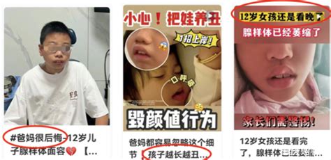 孩子腺样体肥大、腺样体面容怎么办？管管探店【仁品耳鼻喉】 婴幼育儿 重庆购物狂