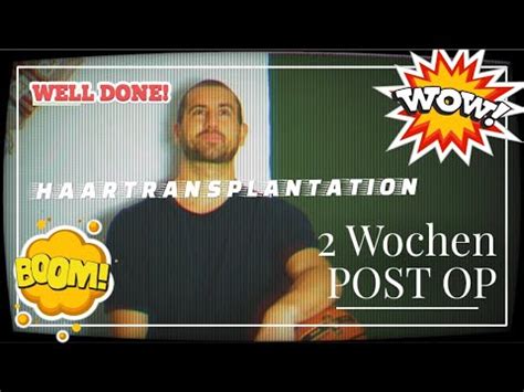 Wochen Haartransplantation Cosmedica Vlog Hairtrainsplant