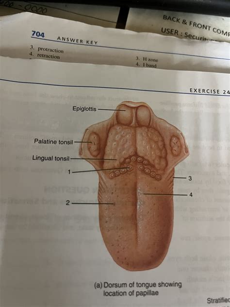 Dorsum of tongue showing location of papillae Diagram | Quizlet