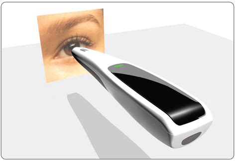 A Compact Fundus Camera To Improve Global Access To Retinal And Optic