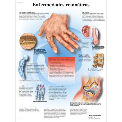 Enfermedades Reum Ticas Vr L Syst Me Squelettique B