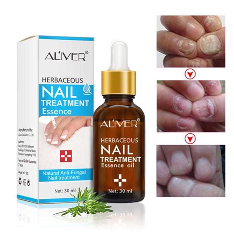 Buy Fungal Nail Repair Liquid Oil Onychomycosis Paronychia Anti Fungal