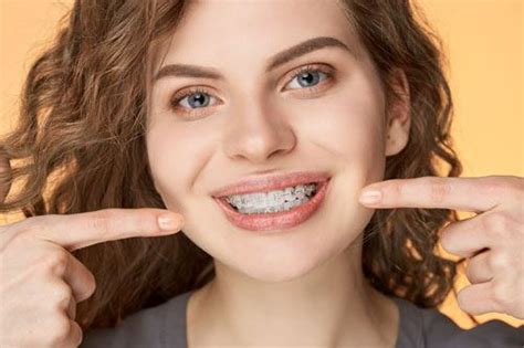 Invisalign Vs Ceramic Braces White Plains Orthodontics