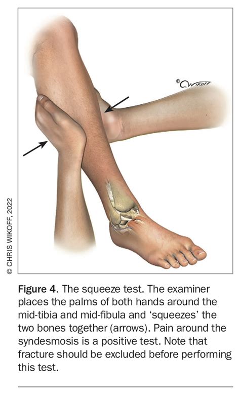 Ankle Sprains The Highs And The Lows Medicine Today