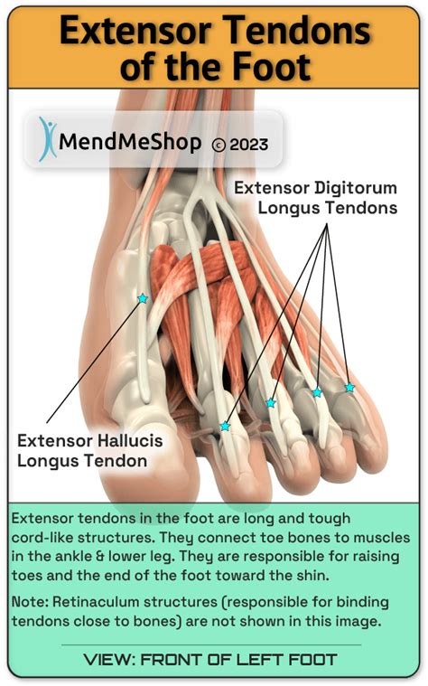 Foot Extensor Tendonitis - Top of Foot Tendonitis