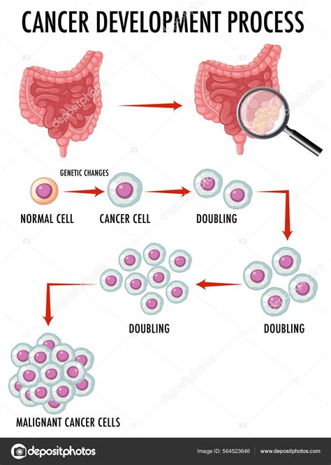 Diagrama Que Muestra Las C Lulas Normales Cancerosas Ilustraci N Humana