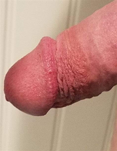 Close Up Of My Penis Head Stunn1