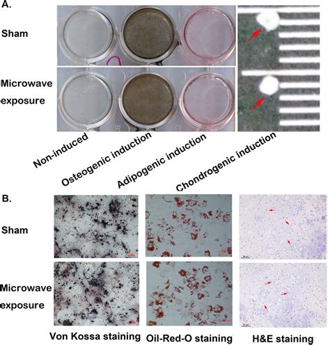 Mscs In Vitro Differentiation After Ghz Microwave Exposure At Sar