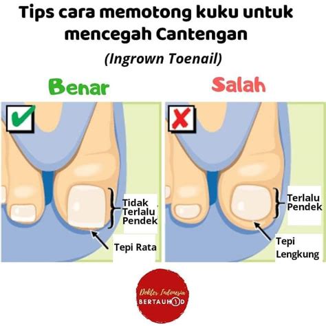 Tips Cara Memotong Kuku Untuk Mencegah Cantengan AtmaGo