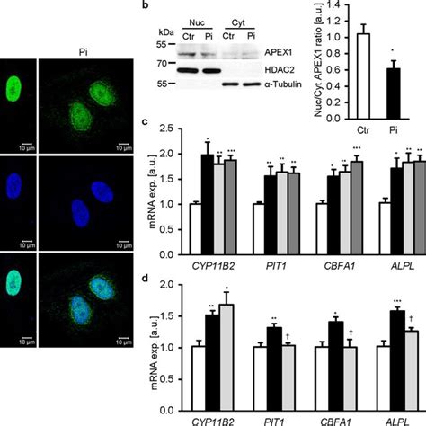 Aldosterone Synthase Inhibition Reduces Phosphate Induced Vascular