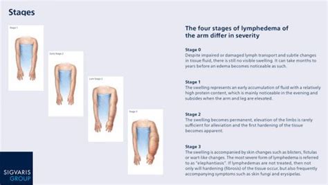 Lymphedema Causes Symptoms And Treatment Updated 2022