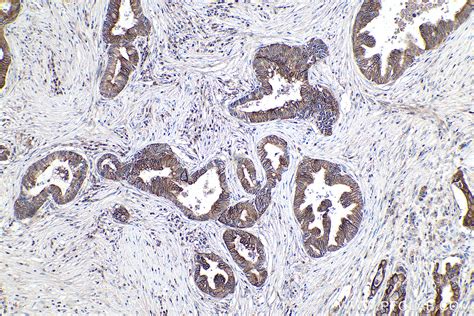 Ihceasy Bid Ready To Use Ihc Kit Khc0403 Proteintech 武汉三鹰生物技术有限公司