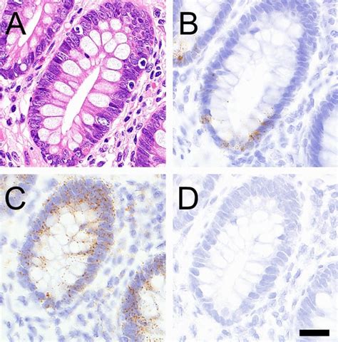 LGR5 Expression For RNAscope Analysis Of The Human Normal Colon A