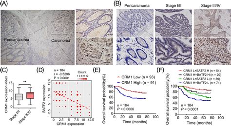 Chromosome Region Maintenance 1 Crm1 Negatively Correlates With