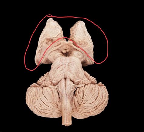 Brain Stem And Sagittal View CNS Flashcards Quizlet