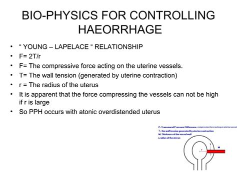 Uterine Compression Sutures Ppt