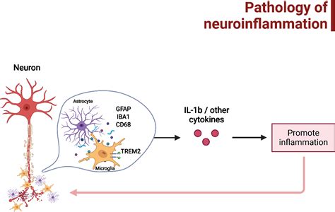 Neuroinflammation A Common Pathway In Alzheimers Disease And Epilepsy