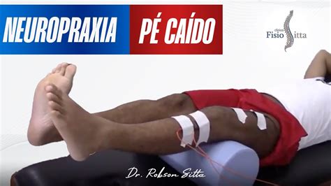 LESÃO do NERVO FIBULAR COMUM e TIBIAL NEUROPRAXIA PÉ CAÍDO