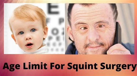 Squint Surgery Age Limit for Children And Adults - EyeMantra