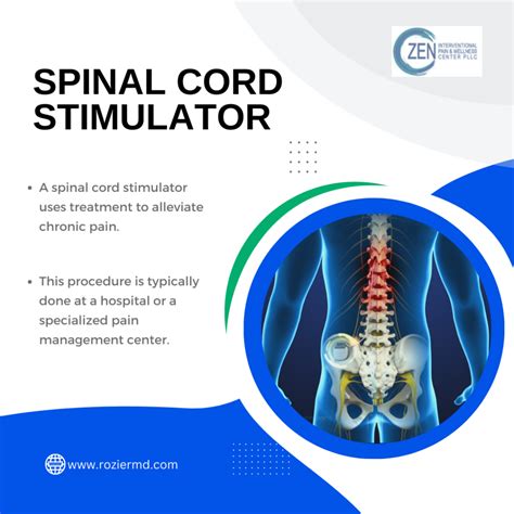 How To Do Implantation Of Spinal Cord Stimulator in Fort Worth, Tx